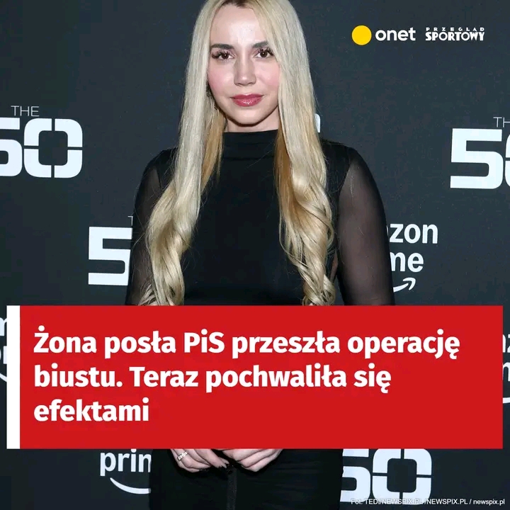 Żona posła PiS pochwaliła się efektami operacji biustu