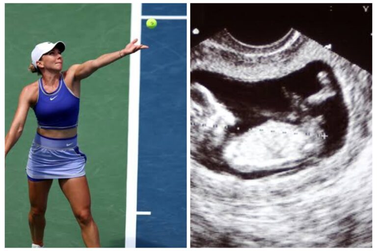 Simona Halep a confirmat vestea sarcinii.